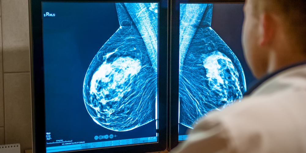 Mammography vs. Breast Ultrasound Screening for Preventative Breast Cancer